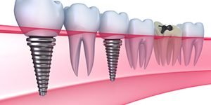 Dentart2001 - Clinica stomatologica